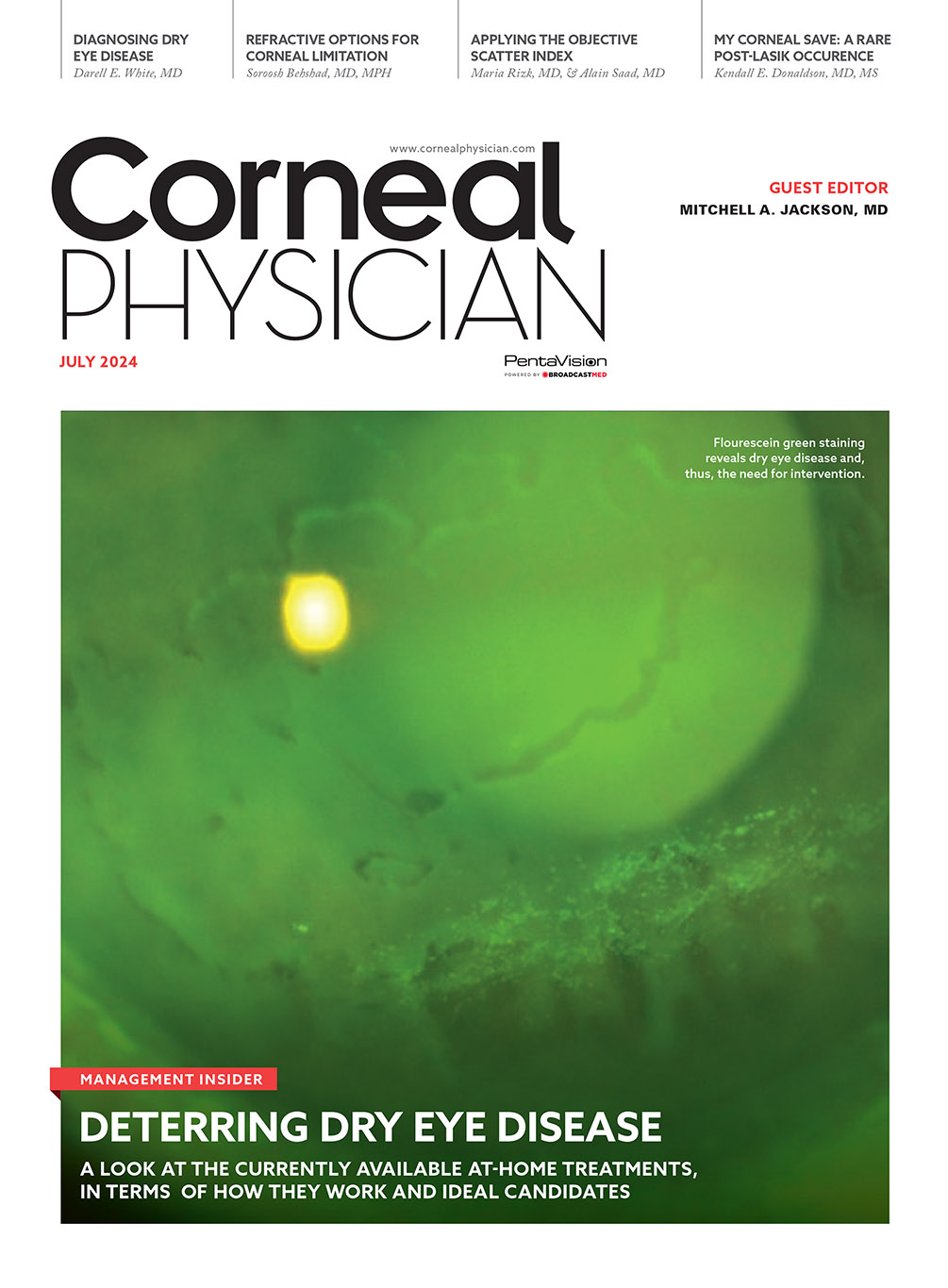 Corneal Physician